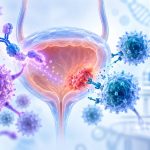 Illustration of immune cells targeting a bladder tumor, with a bank and coins representing Forlong Biotech’s financing.